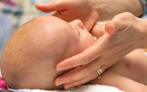 Cradle cap: 3 tips on how to treat seborrhoeic dermatitis in babies